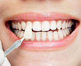 Вставить зубы &ndash; какие лучше?